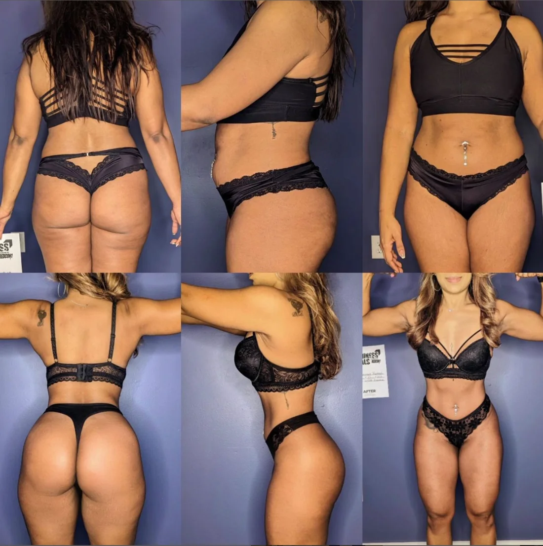 Veronique transformation